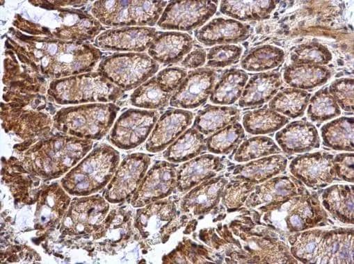 ATOH7 antibody detects ATOH7 protein at cytosol and nucleus on mouse colon by immunohistochemical analysis. Sample: Paraffin-embedded mouse colon. ATOH7 antibody (NBP3-48614) dilution: 1:1000. Antigen Retrieval: (EDTA based, pH 8.0) buffer, 15min 