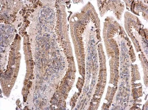Immunohistochemistry ATOH7 Antibody