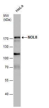 NOL8 antibody detects NOL8 protein by western blot analysis. Whole cell extracts (30 ug) was separated by 7.5 % SDS-PAGE, and blotted with NOL8 antibody (NBP3-48619) diluted by 1:1000 