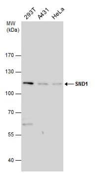 SND1 antibody detects SND1 protein by western blot analysis. Various whole cell extracts (30 ug) were separated by 7.5% SDS-PAGE, and the membrane was blotted with SND1 antibody (NBP3-48621) diluted at a dilution of 1:1000. 