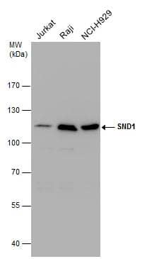 <b>Genetic Strategies Validation. </b>SND1 antibody detects SND1 protein by western blot analysis. Various whole cell extracts (30 ug) were separated by 7.5% SDS-PAGE, and the membrane was blotted with SND1 antibody (NBP3-48621) diluted at a dilution of 1:1000. 