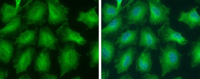 Immunocytochemistry/ Immunofluorescence GNPDA2 Antibody