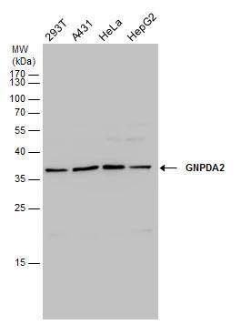 Western Blot GNPDA2 Antibody