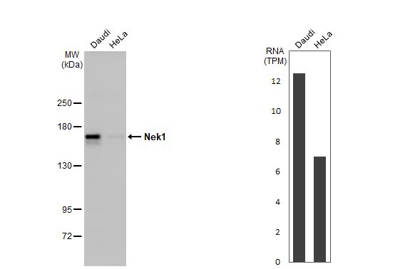 <b>Orthogonal Strategies Validation. </b>Various whole cell extracts (30 ug) were separated by 5% SDS-PAGE, and the membrane was blotted with NEK1 antibody (NBP3-48625) diluted at 1:1000. The HRP-conjugated anti-rabbit IgG antibody was used to detect the primary antibody. Corresponding RNA expression data for the same cell lines are based on Human Protein Atlas program. 