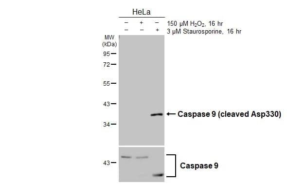 Untreated (-) and treated (+) HeLa whole cell extracts (30 ug) were separated by 10% SDS-PAGE, and the membrane was blotted with active/cleaved Caspase-9 antibody (NBP3-48628) diluted at 1:500. The HRP-conjugated anti-rabbit IgG antibody was used to detect the primary antibody, and the signal was developed with Trident ECL plus-Enhanced. 