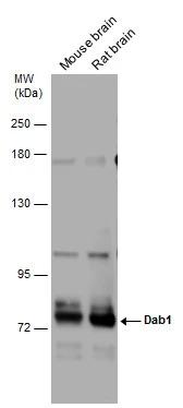 Various tissue extracts (75 ug) were separated by 7.5% SDS-PAGE, and the membrane was blotted with DAB1 antibody (NBP3-48629) diluted at 1:1000. 