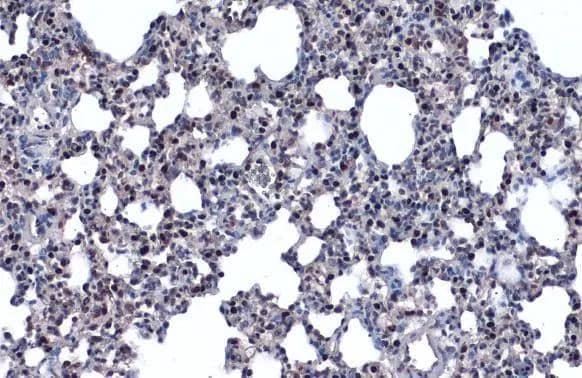 TTF-1 / NKX2-1 antibody detects TTF-1 / NKX2-1 protein at nucleus by immunohistochemical analysis.Sample: Paraffin-embedded mouse lung.TTF-1 / NKX2-1 stained by TTF-1 / NKX2-1 antibody (NBP3-48630) diluted at 1:500.Antigen Retrieval: Citrate buffer, pH 6.0, 15 min 