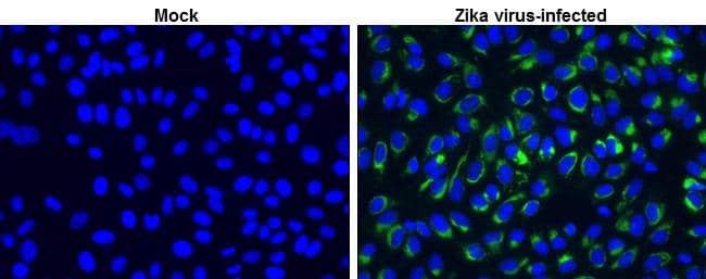 Zika Virus NS1 antibody detects Zika Virus NS1 at cytoplasm by immunofluorescent analysis.Sample: Vero cells were fixed in 4% paraformaldehyde at RT for 30 min.Green: Zika virus NS1 stained by Zika Virus NS1 antibody (NBP3-48633) diluted at 1:1000.Blue: nuclear staining. 