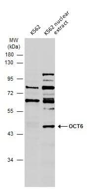 Various whole cell extracts (30 ug) were separated by 10% SDS-PAGE, and the membrane was blotted with OCT6 antibody (NBP3-48636) diluted at 1:500. The HRP-conjugated anti-rabbit IgG antibody was used to detect the primary antibody. 