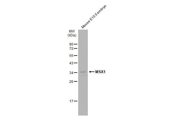 Mouse tissue extract (50 ug) was separated by 12% SDS-PAGE, and the membrane was blotted with MSX1 antibody (NBP3-48637) diluted at 1:1000. The HRP-conjugated anti-rabbit IgG antibody was used to detect the primary antibody. 
