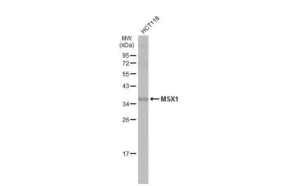 Whole cell extract (30 ug) was separated by 12% SDS-PAGE, and the membrane was blotted with MSX1 antibody (NBP3-48637) diluted at 1:1000. The HRP-conjugated anti-rabbit IgG antibody was used to detect the primary antibody. 