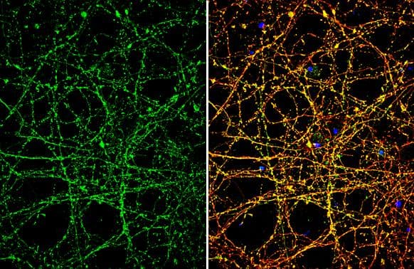 Immunocytochemistry/ Immunofluorescence Nav1.7 Antibody