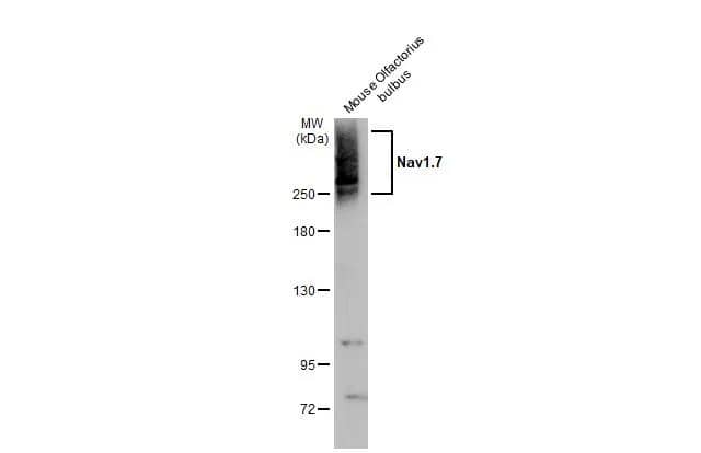Western Blot Nav1.7 Antibody