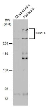 Western Blot Nav1.7 Antibody