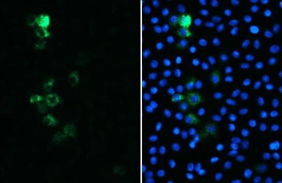 SARS Spike Protein antibody [1A9] detects SARS-CoV-2 by immunofluorescent analysis.Sample: Vero E6 cells were infected with SARS-CoV-2 (MOI of 1) and fixed with chilled methanol/acetone.Green: SARS-CoV-2 infected Vero E6 cells stained by SARS Spike Protein antibody [1A9] (NBP3-48646).Blue: Nuclei were counterstained with DAPI.*From Zheng Z, et al. bioRxiv(2020). Shown under license agreement 