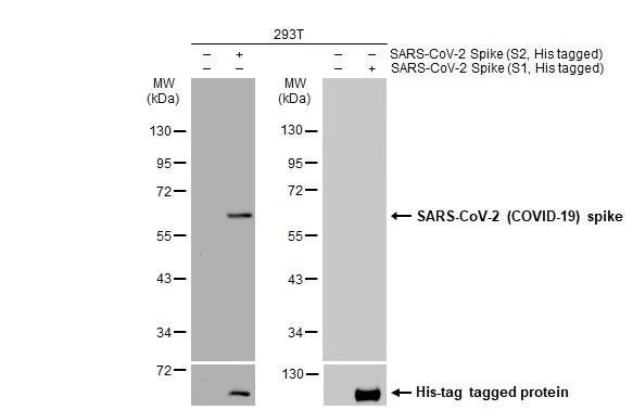 Non-transfected (�) and transfected (+) 293T whole cell extracts (30 ?g) were separated by 10% SDS-PAGE, and the membrane was blotted with SARS Spike Protein antibody [1A9] (NBP3-48646) diluted at 1:5000. The HRP-conjugated anti-mouse IgG antibody was used to detect the primary antibody. 