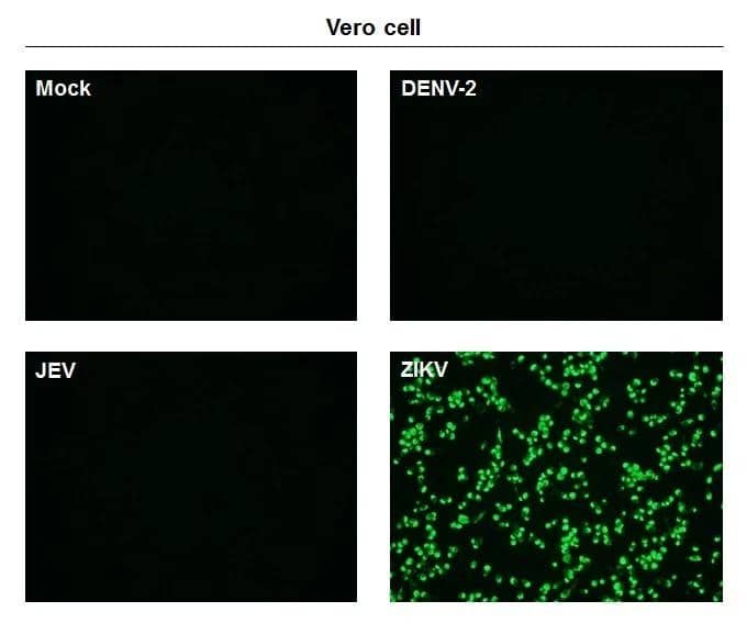 Immunofluorescent analysis of non-infected and infected vero cells using Zika Virus Envelope antibody [GT871] (NBP3-48648). Green: Zika Virus Envelope antibody [GT871] (NBP3-48648) diluted at 1:500. 