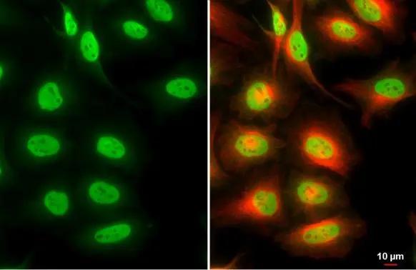 BRM antibody [HL1114] detects BRM protein at nucleus by immunofluorescent analysis.Sample: HeLa cells were fixed in 4% paraformaldehyde at RT for 15 min.Green: BRM stained by BRM antibody [HL1114] (NBP3-48649) diluted at 1:500.Red: alpha Tubulin, a cytoskeleton marker, stained by alpha Tubulin antibody [GT114] diluted at 1:1000. 