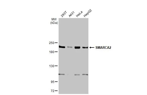 Various whole cell extracts (30 ug) were separated by 5% SDS-PAGE, and the membrane was blotted with BRM antibody [HL1114] (NBP3-48649) diluted at 1:1000. The HRP-conjugated anti-rabbit IgG antibody was used to detect the primary antibody. 