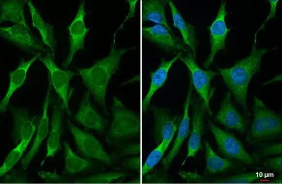 RRM2 antibody [HL1235] detects RRM2 protein at cytoplasm by immunofluorescent analysis.Sample: HeLa cells were fixed in 4% paraformaldehyde at RT for 15 min.Green: RRM2 stained by RRM2 antibody [HL1235] (NBP3-48650) diluted at 1:500.Blue: Fluoroshield with DAPI . 