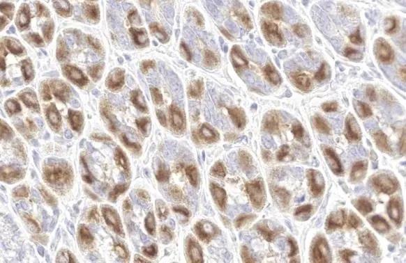 Immunohistochemistry-Paraffin NEK7 Antibody (HL1349)