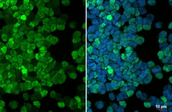 PDE6D antibody [HL1359] detects PDE6D protein at nucleus by immunofluorescent analysis.Sample: MOLT-4 cells were fixed in 4% paraformaldehyde at RT for 15 min.Green: PDE6D stained by PDE6D antibody [HL1359] (NBP3-48654) diluted at 1:500.Blue: Fluoroshield with DAPI . 