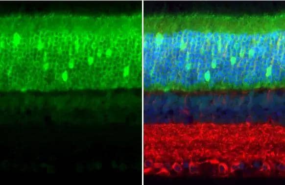 PDE6D antibody [HL1359] detects PDE6D protein at cytoplasm by immunohistochemical analysis.Sample: Paraffin-embedded mouse eye.Green: PDE6D stained by PDE6D antibody [HL1359] (NBP3-48654) diluted at 1:100.Red: beta Tubulin 3/ Tuj1, a neural marker, stained by beta Tubulin 3/ Tuj1 antibody [GT11710] diluted at 1:500.Blue: Fluoroshield with DAPI .Antigen Retrieval: Citrate buffer, pH 6.0, 15 min 