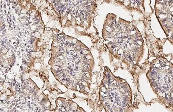 PDE6D antibody [HL1359] detects PDE6D protein at cytoplasm by immunohistochemical analysis.Sample: Paraffin-embedded cat colon.PDE6D stained by PDE6D antibody [HL1359] (NBP3-48654) diluted at 1:100.Antigen Retrieval: Citrate buffer, pH 6.0, 15 min 