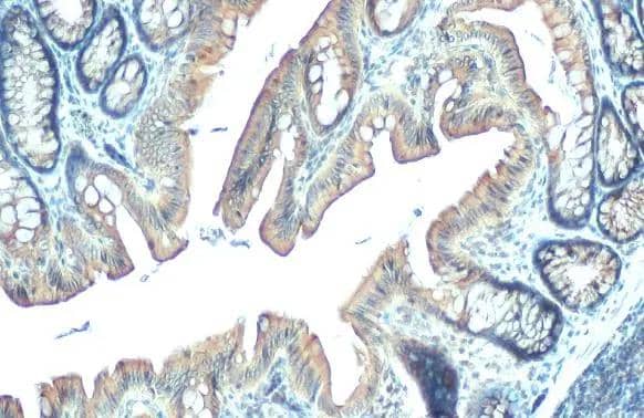 PDE6D antibody [HL1359] detects PDE6D protein at cytoplasm by immunohistochemical analysis.Sample: Paraffin-embedded rat colon.PDE6D stained by PDE6D antibody [HL1359] (NBP3-48654) diluted at 1:100.Antigen Retrieval: Citrate buffer, pH 6.0, 15 min 