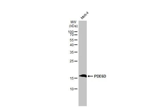 Whole cell extract (30 ug) was separated by 15% SDS-PAGE, and the membrane was blotted with PDE6D antibody [HL1359] (NBP3-48654) diluted at 1:1000. The HRP-conjugated anti-rabbit IgG antibody was used to detect the primary antibody. 