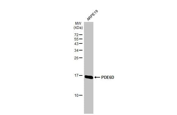 Whole cell extract (30 ug) was separated by 15% SDS-PAGE, and the membrane was blotted with PDE6D antibody [HL1359] (NBP3-48654) diluted at 1:1000. The HRP-conjugated anti-rabbit IgG antibody was used to detect the primary antibody. 