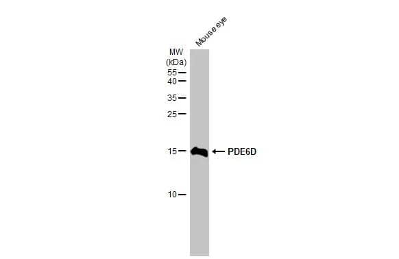 Mouse tissue extract (50 ug) was separated by 15% SDS-PAGE, and the membrane was blotted with PDE6D antibody [HL1359] (NBP3-48654) diluted at 1:1000. The HRP-conjugated anti-rabbit IgG antibody was used to detect the primary antibody. 