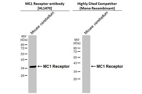 Western Blot Melanocortin-1 R/MC1R Antibody (HL1470)
