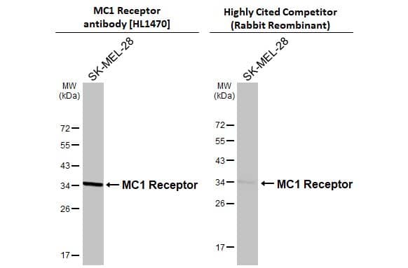 Western Blot Melanocortin-1 R/MC1R Antibody (HL1470)