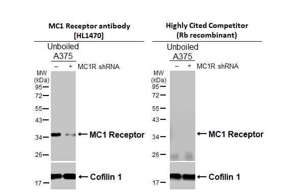 Western Blot Melanocortin-1 R/MC1R Antibody (HL1470)