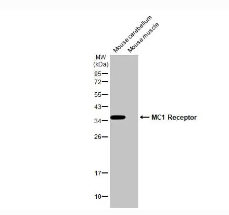 Western Blot Melanocortin-1 R/MC1R Antibody (HL1470)