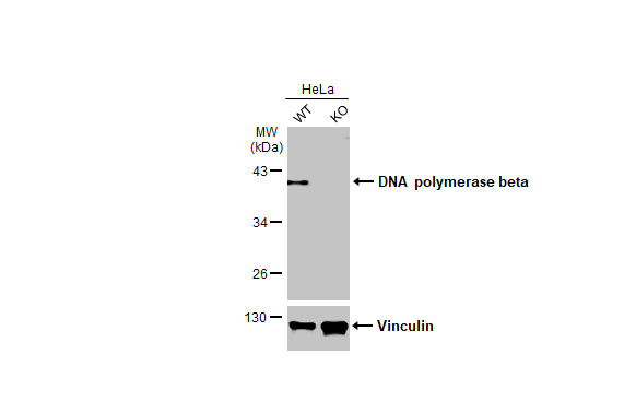 <b>Genetic Strategies Validation. </b>Wild-type (WT) and POLB knockout (KO) HeLa cell extracts (30 ?g) were separated by 10% SDS-PAGE, and the membrane was blotted with DNA Polymerase beta antibody [HL1512] (NBP3-48656) diluted at 1:1000. The HRP-conjugated anti-rabbit IgG antibody was used to detect the primary antibody, and the signal was developed with Trident ECL plus-Enhanced. 