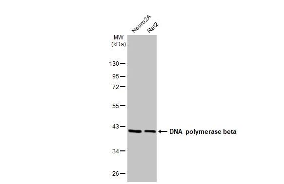 Various whole cell extracts (30 ?g) were separated by 10% SDS-PAGE, and the membrane was blotted with DNA Polymerase beta antibody [HL1512] (NBP3-48656) diluted at 1:1000. The HRP-conjugated anti-rabbit IgG antibody was used to detect the primary antibody. 