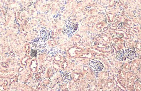 Puromycin-sensitive aminopeptidase/NPEPPS antibody [HL1531] detects Puromycin-sensitive aminopeptidase/NPEPPS protein at cytoplasm by immunohistochemical analysis.Sample: Paraffin-embedded mouse kidney.Puromycin-sensitive aminopeptidase/NPEPPS stained by Puromycin-sensitive aminopeptidase/NPEPPS antibody [HL1531] (NBP3-48658) diluted at 1:100.Antigen Retrieval: Citrate buffer, pH 6.0, 15 min 