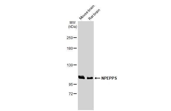 Various tissue extracts (50 ug) were separated by 5% SDS-PAGE, and the membrane was blotted with Puromycin-sensitive aminopeptidase/NPEPPS antibody [HL1531] (NBP3-48658) diluted at 1:3000. The HRP-conjugated anti-rabbit IgG antibody was used to detect the primary antibody. 