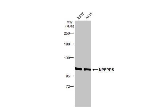 Western Blot Puromycin-sensitive aminopeptidase/NPEPPS Antibody (HL1531)