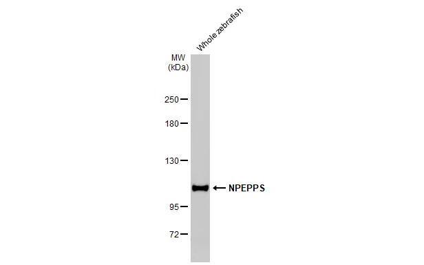 Whole zebrafish extract (30 ug) was separated by 5% SDS-PAGE, and the membrane was blotted with Puromycin-sensitive aminopeptidase/NPEPPS antibody [HL1531] (NBP3-48658) diluted at 1:1000. The HRP-conjugated anti-rabbit IgG antibody was used to detect the primary antibody. 
