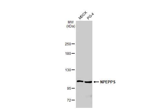 Various whole cell extracts (30 ug) were separated by 5% SDS-PAGE, and the membrane was blotted with Puromycin-sensitive aminopeptidase/NPEPPS antibody [HL1531] (NBP3-48658) diluted at 1:1000. The HRP-conjugated anti-rabbit IgG antibody was used to detect the primary antibody. 