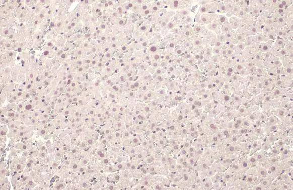 U2AF2 antibody [HL1583] detects U2AF2 protein at nucleus by immunohistochemical analysis.Sample: Paraffin-embedded mouse liver.U2AF2 stained by U2AF2 antibody [HL1583] (NBP3-48659) diluted at 1:100.Antigen Retrieval: Citrate buffer, pH 6.0, 15 min 