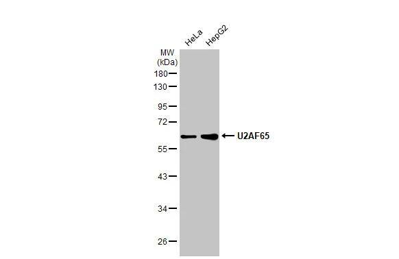 Various whole cell extracts (30 ug) were separated by 10% SDS-PAGE, and the membrane was blotted with U2AF2 antibody [HL1583] (NBP3-48659) diluted at 1:1000. The HRP-conjugated anti-rabbit IgG antibody was used to detect the primary antibody. 