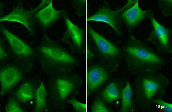STAM-1 antibody [HL1637] detects STAM-1 protein at endosome by immunofluorescent analysis.Sample: HeLa cells were fixed in 4% paraformaldehyde at RT for 15 min.Green: STAM-1 stained by STAM-1 antibody [HL1637] (NBP3-48660) diluted at 1:500.Blue: Fluoroshield with DAPI . 