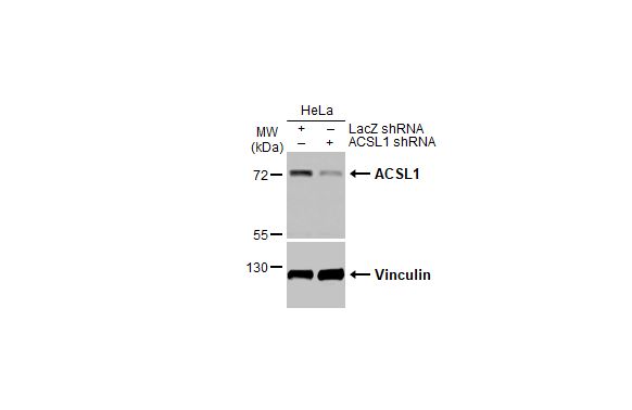 <b>Genetic Strategies Validation and Orthogonal Strategies Validation.</b>Non-transfected (-) and transfected (+) HeLa whole cell extracts (30 ug) were separated by 7.5% SDS-PAGE, and the membrane was blotted with ACSL1 antibody [HL1651] (NBP3-48661) diluted at 1:1000. The HRP-conjugated anti-rabbit IgG antibody was used to detect the primary antibody. 