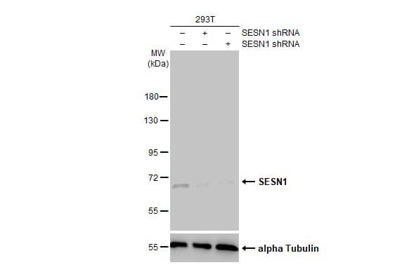 Non-transfected (-) and transfected (+) 293T whole cell extracts (30 ug) were separated by 7.5% SDS-PAGE, and the membrane was blotted with SESN1 antibody [HL1750] (NBP3-48662) diluted at 1:2000. The HRP-conjugated anti-rabbit IgG antibody was used to detect the primary antibody, and the signal was developed with Trident ECL plus-Enhanced. 