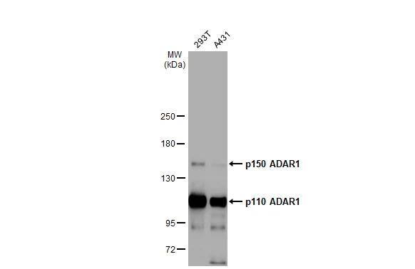 Various whole cell extracts (30 ug) were separated by 5% SDS-PAGE, and the membrane was blotted with ADAR antibody [HL1789] (NBP3-48664) diluted at 1:1000. The HRP-conjugated anti-rabbit IgG antibody was used to detect the primary antibody. 
