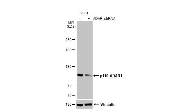 <b>Genetic Strategies Validation. </b>Non-transfected (-) and transfected (+) 293T whole cell extracts (30 ug) were separated by 5% SDS-PAGE, and the membrane was blotted with ADAR antibody [HL1789] (NBP3-48664) diluted at 1:5000. The HRP-conjugated anti-rabbit IgG antibody was used to detect the primary antibody. 